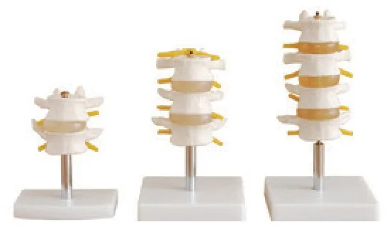 Conjunto de vértebras lumbares (2/3/4 piezas) — VIC Science