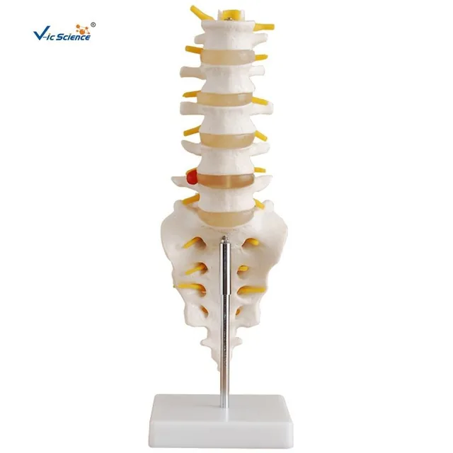 Vértebras lumbares con sacro, cóccix y hernia discal — VIC Science