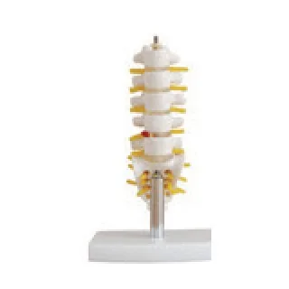 Vértebras lumbares mini con sacro, cóccix y hernia discal — VIC Science