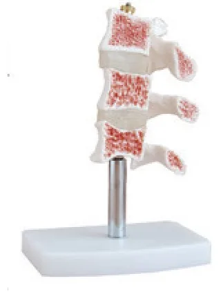 Modelo seccionado de osteoporosis vertebral — VIC Science