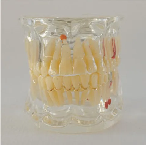 Modelo de patología dental con implante — VIC Science