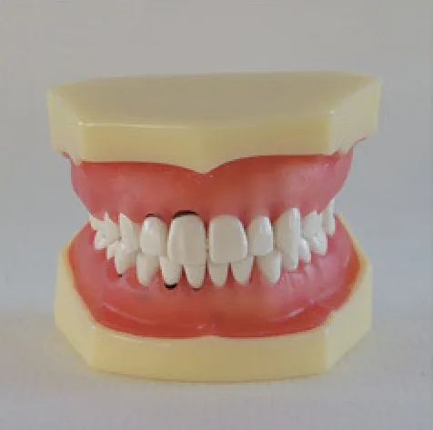 Modelo de enfermedad periodontal — VIC Science