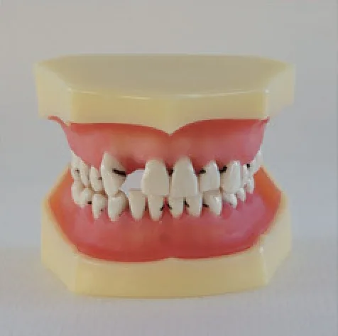 Modelo de enfermedad periodontal tipo L4 — VIC Science