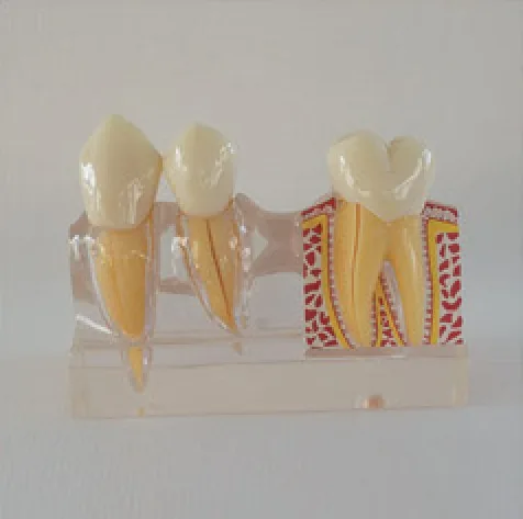 Modelo desmontable de dientes ampliado 4 veces — VIC Science