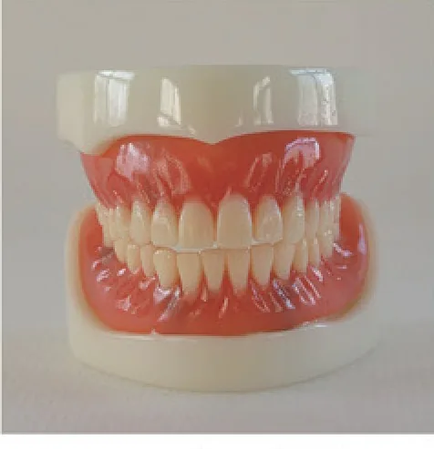 Modelo de implante para dentadura completa — VIC Science