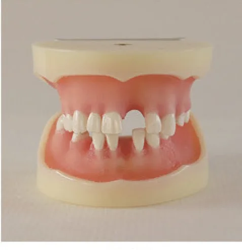 Dental Implant Model — VIC Science